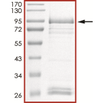 EGFR (d746-750 T790M), Active